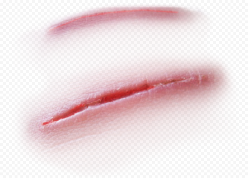 Wound effect, wound, scratch, skin injury